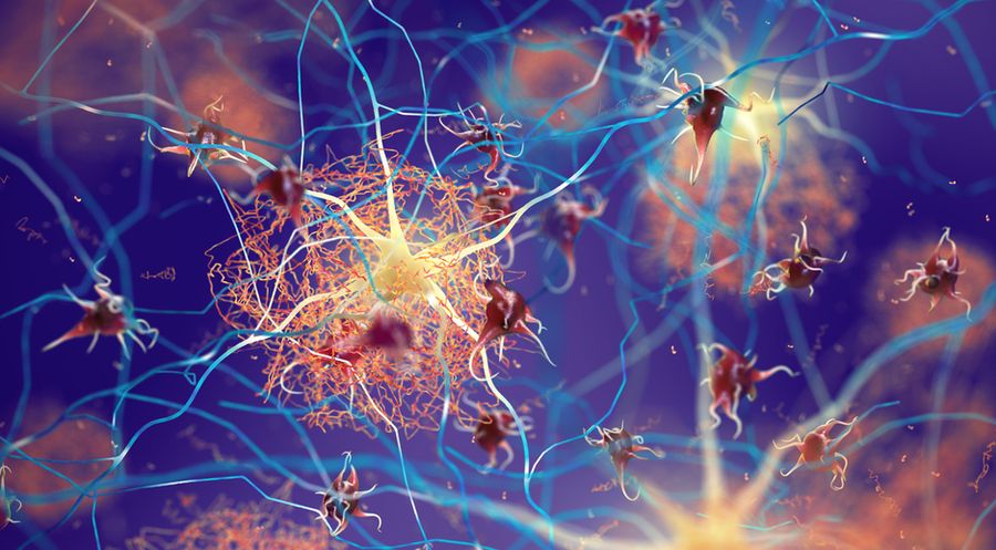 Bilim insanlarından Alzheimer’a karşı yeni model: SHIELD nedir? Bilim insanlarından Alzheimer’a karşı yeni model: SHIELD nedir?