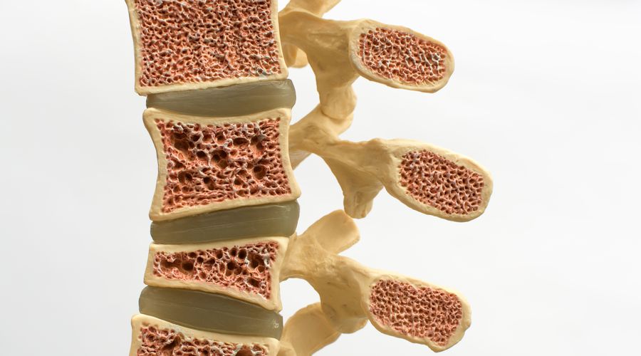 İnsan kemiklerinin derinliklerinde mikroplastik bulundu İnsan kemiklerinin derinliklerinde mikroplastik bulundu