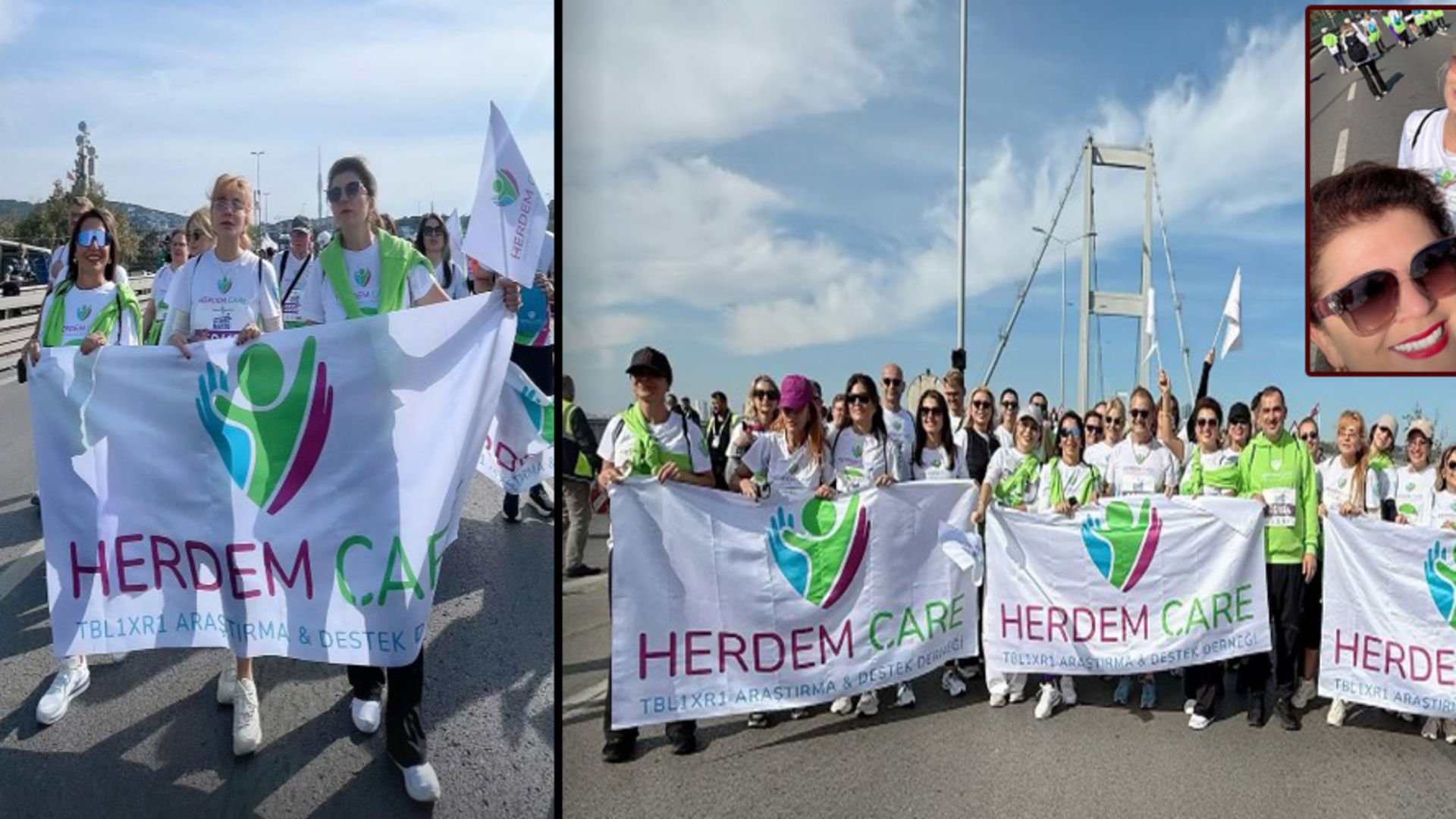 Herdem Çare Derneği, İstanbul Maratonu’nda Koştu Herdem Çare Derneği, İstanbul Maratonu’nda Koştu